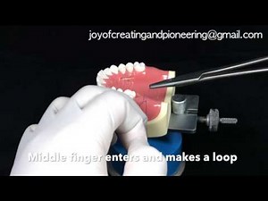 Back to the suture - Security loop suture