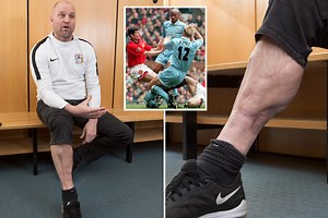 How David Busst recovered from 22 operations to lead Coventry's efforts in community