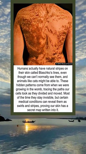The Invisible Lines Written on Every Human