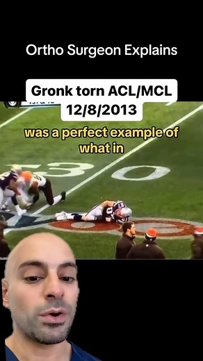 5.2K views · 25 reactions | Unhappy Triad of the Knee- Torn MCL, medial meniscus, torn ACL. The force on the outside part of the knee, stretches the inside and inner structures. ✅Follow @drdavidabbasi for More Daily Medical Content & Health Tips! #acl #mcl #gronk #nfl #football #unhappytriad | David Abbasi, MD - Sports Medicine & Orthopedic Surgery | Facebook