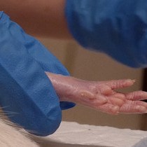 Video: Remote Limb Ischemic Preconditioning:  A Neuroprotective Technique in Rodents