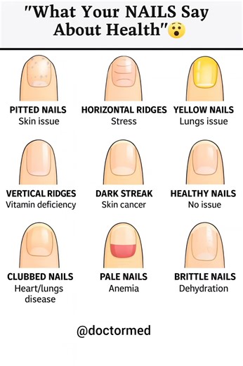 DANGER SIGNS ON YOUR NAILS
