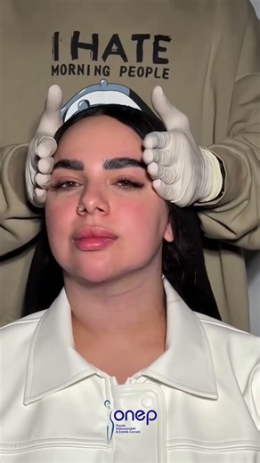 “Why Does the Face Look Tired as We Age? The Anatomical Truth…”