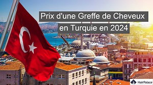 Prix d'une Greffe de Cheveux en Turquie en 2025