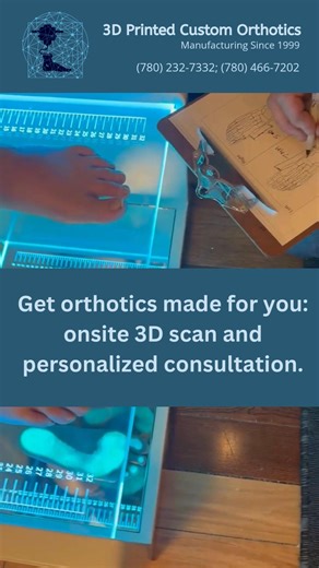 3D Printed Custom Orthotics | 3D Printed Custom Orthotics