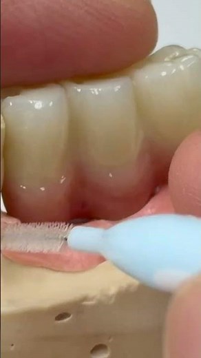 How to clean implants!