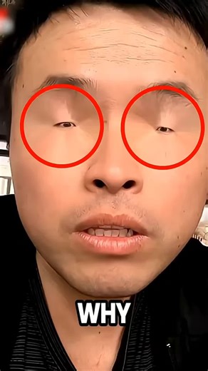 The Science Behind East Asian Eyes 🫩 | eyes