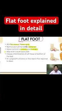 Flat Foot Explained in Detail | Physical Education | Rahul Sir