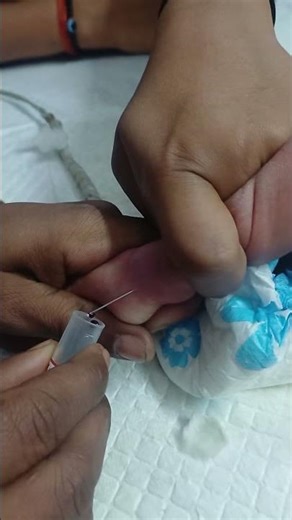 blood sampleing 🐥#cute #baby