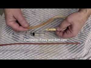 Catheter removed after Bladder neck scar tissue surgery (Feb 2018)