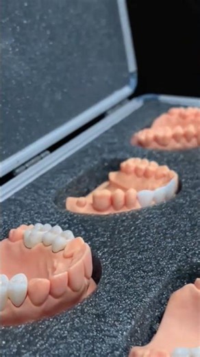 #invisalignpune #weddingdress #weddingdress #smiledesigndental #clearaligners