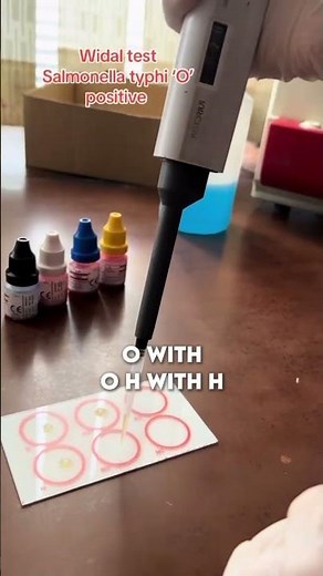 Widal Test Explained in 30 Seconds! 🔬💉