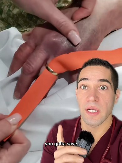 Essential First Aid Tips for Stuck Rings