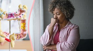 Jag tog bort polyper i tarmen – kommer jag få tarmcancer?