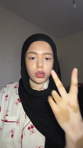 Cheetah Print: A Fashion Statement That Lasts