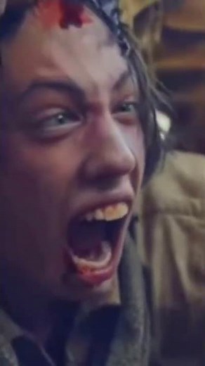 What is Scalping like ?