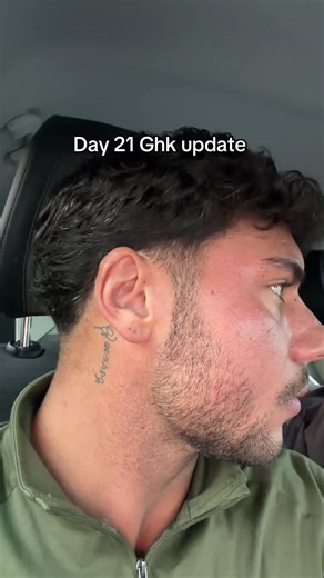 GHK glow pen Day 21 update 👀 week 3 check-in... (1 day late 😶) keeping it consistent and letting it build. Skin's looking a bit brighter and smoother, and it's starting to get that clean