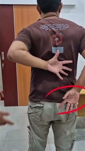 Cedera Otot Lengan Kiri Hingga Susah Digerakan