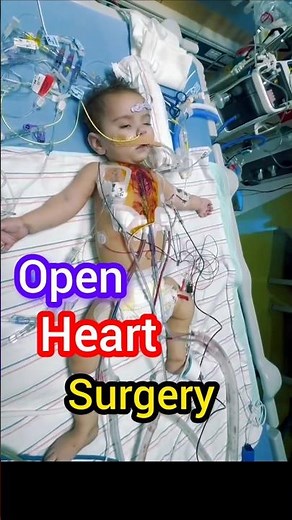 Open Heart Surgery