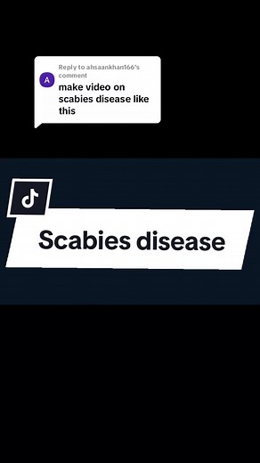 Understanding Scabies Disease: Symptoms and Treatment