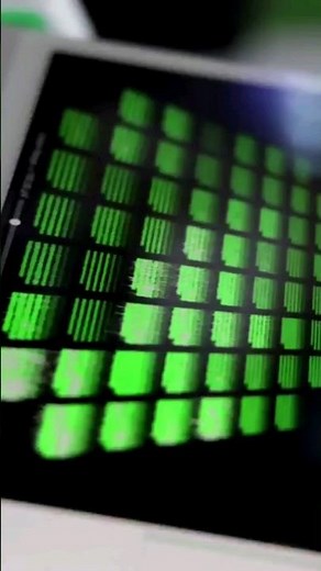 World's First Biological Computer: CL1 Powered by Human Brain Cells!#shorts