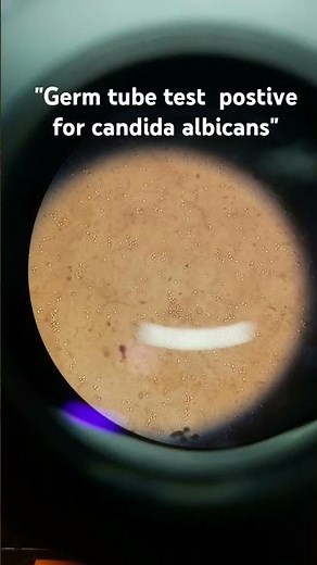 ## germ tube test ## candida albicans ## microbiology ##