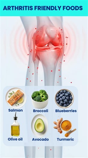 6 Best Anti-Inflammatory Foods for Arthritis Joint Pain Relief