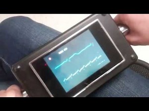Hand ECG using Arduino and TV
