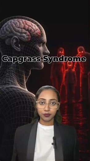 When familiarity disappears | Capgrass Syndrome