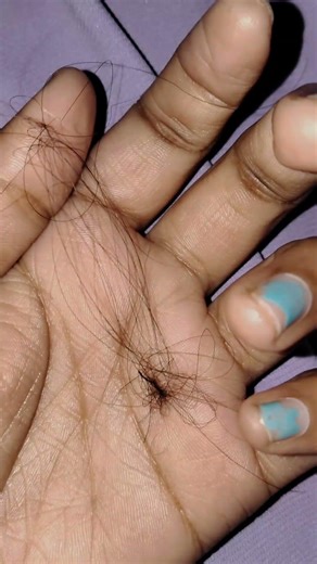 I lost a lot 🥲 #shortsfeed #shortstrending #hair #like #trend #sad #viral #trending #shorts #explore