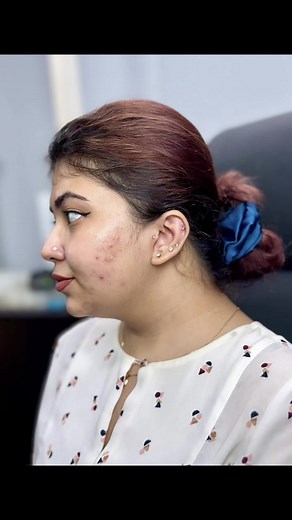 After manifesting for a year,I finally got a tragus piercing done by my favourite @exoticpiercingbd😭❤️ #fyp #foryou #simplynoura #piercing #piercingcheck #piercingstudio #piercetok