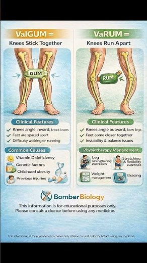 genu valgum and genu varum, two types of knee alignment conditions