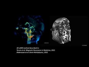 3D aMRI CSF and whole brain