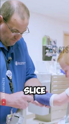 Why This Cast Cutter Doesn’t Hurt Your Skin ⚙️🦴