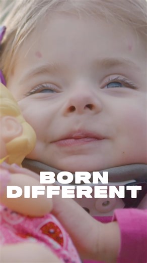 27K views · 331 reactions | Meet the children born to inspire ❤️ #reels #viral #borndifferent #truly #kids #inspirational #rareconditions | Born Different | Facebook