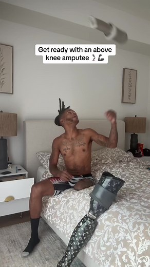 How an Above-Knee Amputee Gets Dressed Daily