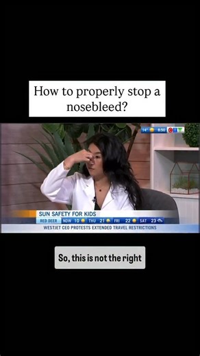 Stephanie Liu on Instagram: "Learn how to PROPERLY stop a nosebleed. 🛑 Don’t pinch the bridge of your nose, this won’t help! ✅ Pinch the soft area towards the bottom of the nose (nasal alae). ✅ Tilt your head forward. This will drain blood into the nose instead of into the back of the throat. ✅ Squeeze your nose shut for at least 15 minutes. In children, squeeze for only 10 minutes. Do not realize the pressure until before the time is up. If you keep checking it will reduce the likelihood of th