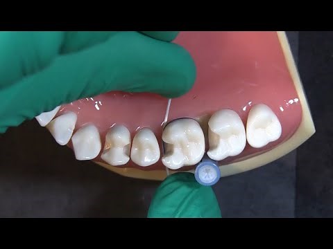Uses for the Deep Margin Elevation Kit from Garrison with Dr. JD Corey