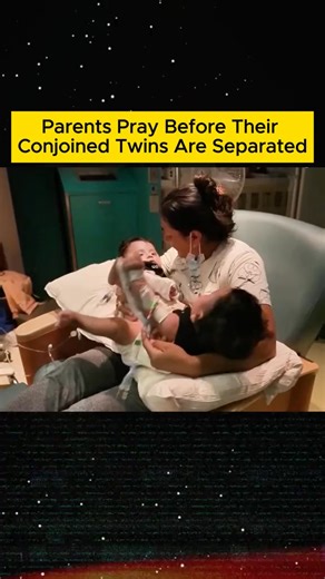 521K views · 8.7K reactions | Parents Pray Before Their Conjoined Twins Are Separate Part 1 #tiktok #twins #conjoinedtwins #baby #newborn #viralvideo #fyp | Gibi | Facebook