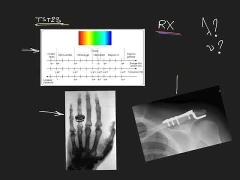 Rayons X - Radiographie - TST2S