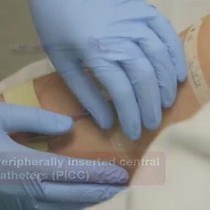 Central Venous Access Device Dressing Change