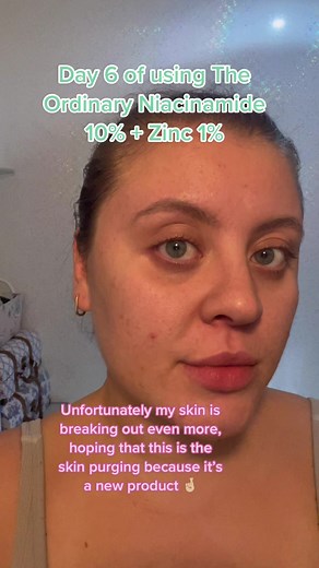 Understanding Skin Purging from The Ordinary Niacinamide