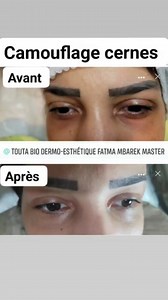 Camouflage cernes #TOUTADERMO #SoinsVisage #Hydrafacial #LEDthérapie | TOUTA DERMO