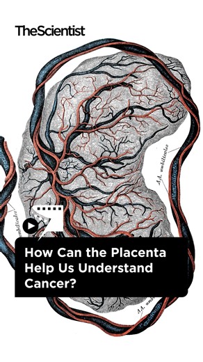 The placenta and cancer probably seem like totally different biological entities. While they are indeed very different, researchers also observe many parallels between these two structures. Find out how studying one could inform scientists about the other in this video! | The Scientist