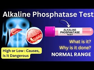 Alkaline Phosphatase Test - Meaning, Procedure, Normal Range, R Value | ALP Blood Test for Liver