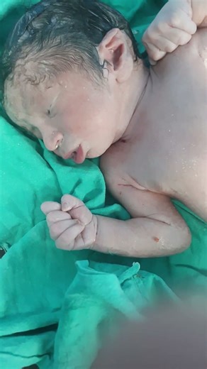 Newborn Baby’s First Cry Immediately After Birth in Labor Room #foryou #youtubeshorts