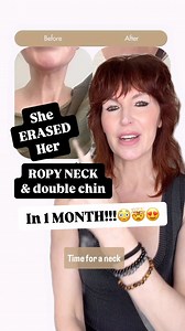 16K views · 305 reactions | FREE Neck Workout that Works! Comment...