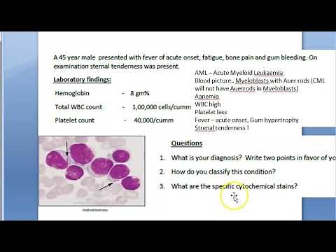 Pathology 356 a AML Case Study Acute Myeloid Leukemia Auer rod myeloblast classification WHO FAB