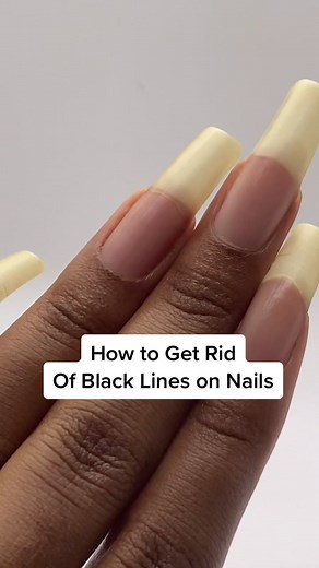 If you have vertical lines on nails, watch this. #naturalnails #nailcare #ClearGenius #healthynails #nailhacks