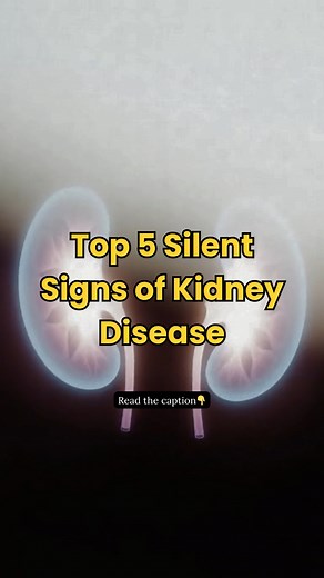 Watch for these quiet warning signs: ✔️ Foamy urine ✔️ Swollen feet ✔️ Tiredness ✔️ Night urination ✔️ High BP 💚 Don’t ignore the whispers. Follow for more updates. #kidneydisease #kidneydiseaseawareness #kidneywarrior #kidneyfailure #kidneypatient #fblifestyle #kidney #kidneycare | The Kidney Disease Solution